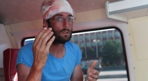 yabancı dövüldü
